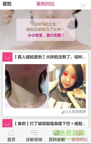 瘦脸